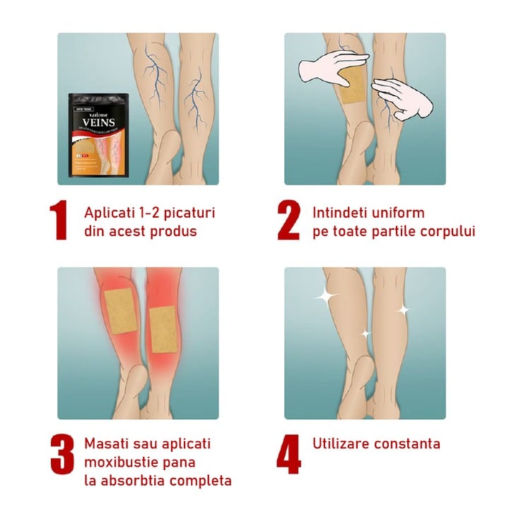 Set Plasturi Tratament Varice și Picioare Grele cu Extracte Naturale din Plante